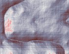 irene feder