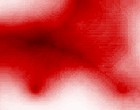 stodmpfer test